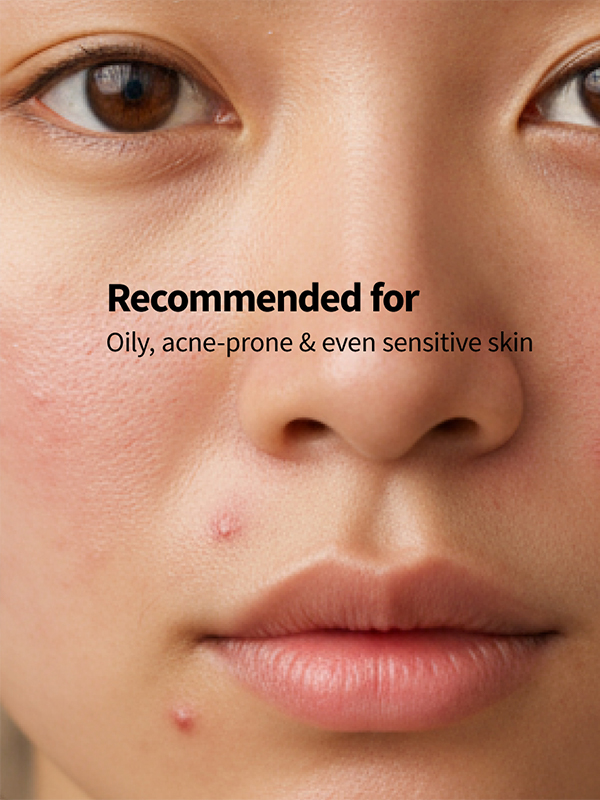 5% Niacinamide + Zinc